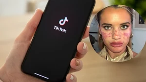 21-latka wykonała jeden z trendów urodowych z TikToka. Zakończyło się wizytą w szpitalu (Instagram)