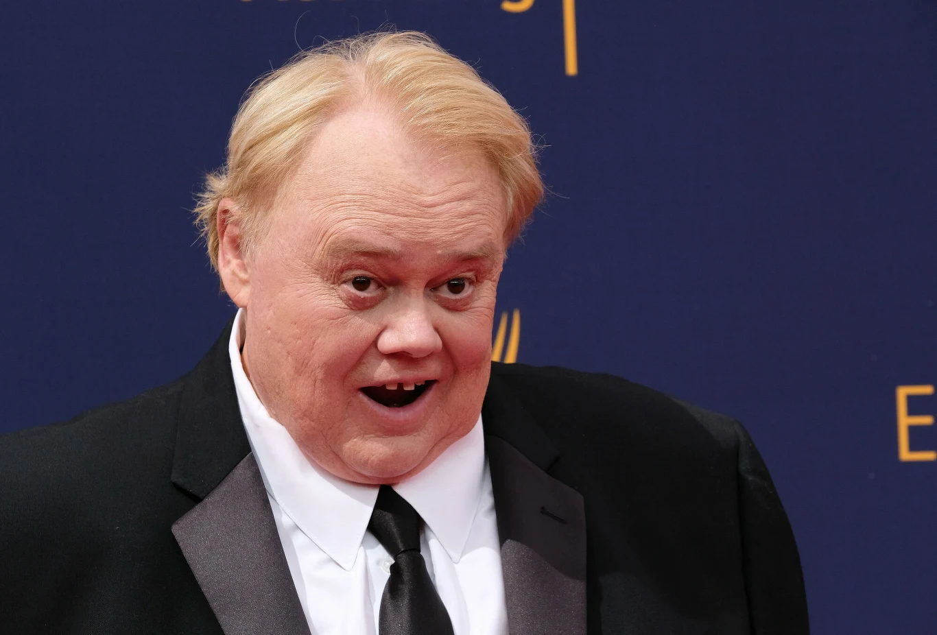 Louie Anderson Louie Anderson