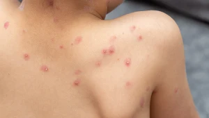 To wina Brytyjczyków. Poznaliśmy przyczynę niszczycielskiej epidemii z 1789