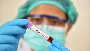 Rewolucyjny zastrzyk chroniący przed HIV. Są wyniki pierwszych testów