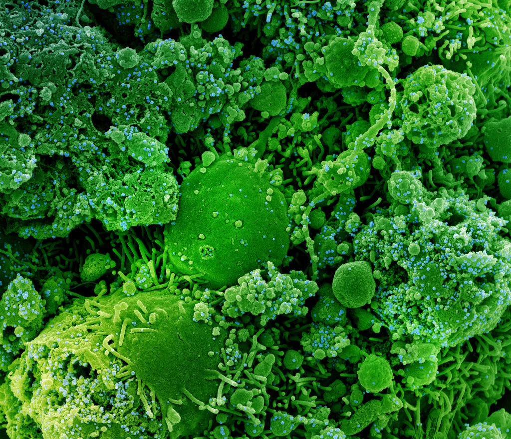Komórki (na zielono) zainfekowane SARS-CoV-2 (niebieskie kropki)