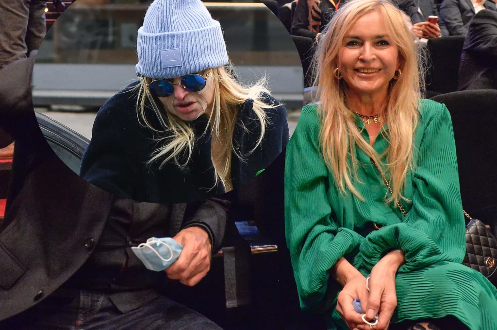 Monika Olejnik z plastrami na twarzy