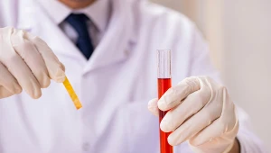 Kwasica. Podstępny stan zagrażający zdrowiu