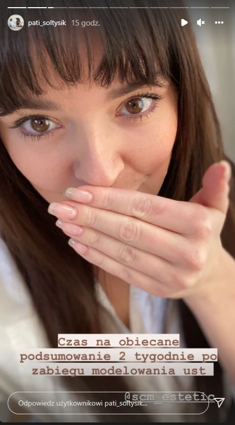 Patrycja Sołtysik na IG chwali się nowymi ustami @pati_soltysik Patrycja Sołtysik na IG chwali się nowymi ustami @pati_soltysik