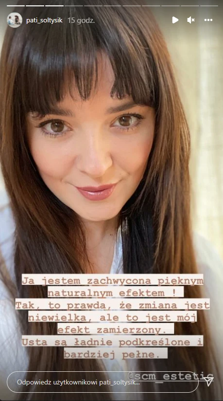 Patrycja Sołtysik na IG chwali się nowymi ustami @pati_soltysik Patrycja Sołtysik na IG chwali się nowymi ustami @pati_soltysik