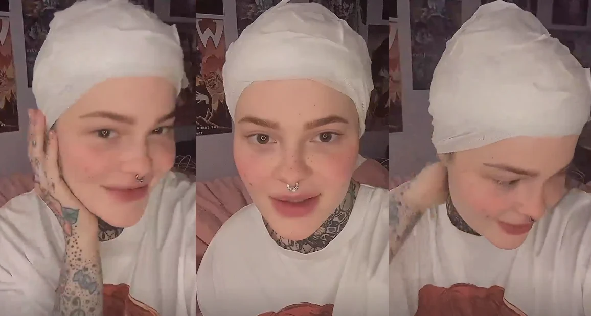 Monika Miller po operacji https://www.instagram.com/monika.milller/