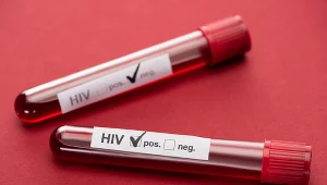 HIV. Wirus, którego można wyleczyć