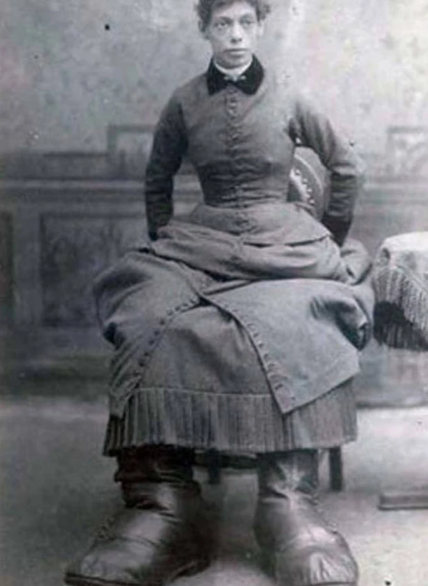 Mills występowała przed publicznością jako „Kobieta z Ohio o wielkich stopach”.