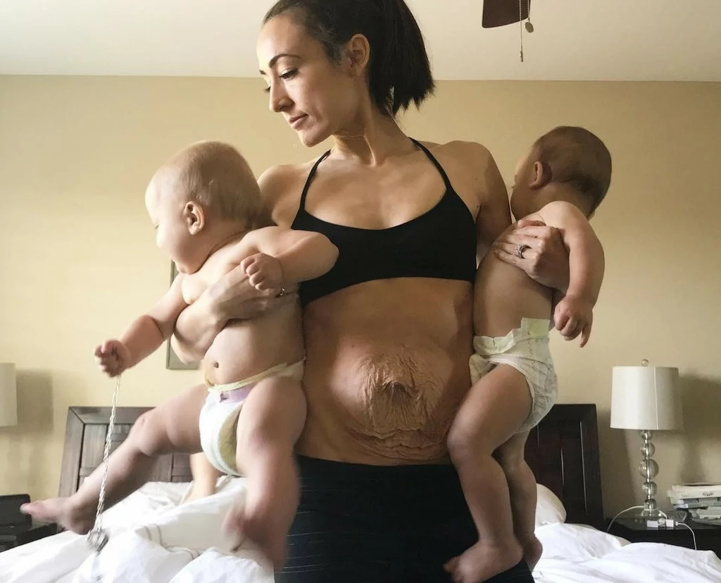 Instagramerka urodziła bliźniaki i po porodzie nie mogła wrócić do pełnej formy 