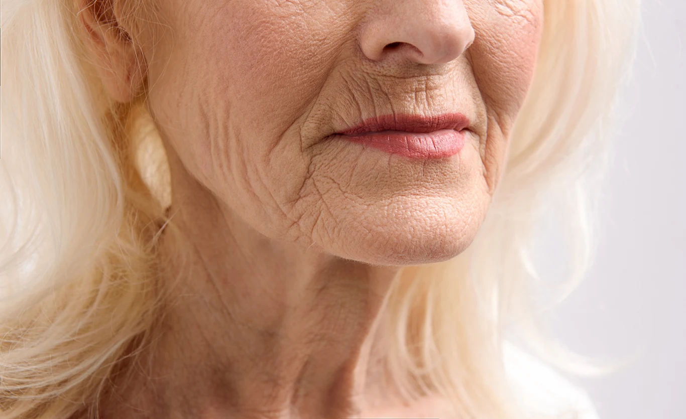 Stres może prowadzić do pojawienia się niechcianych zmarszczek Stres może prowadzić do pojawienia się niechcianych zmarszczek