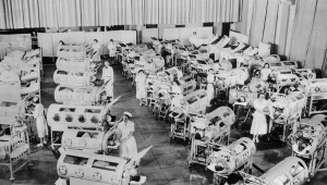 Epidemię polio zatrzymało opracowanie szczepionki. To groźna choroba