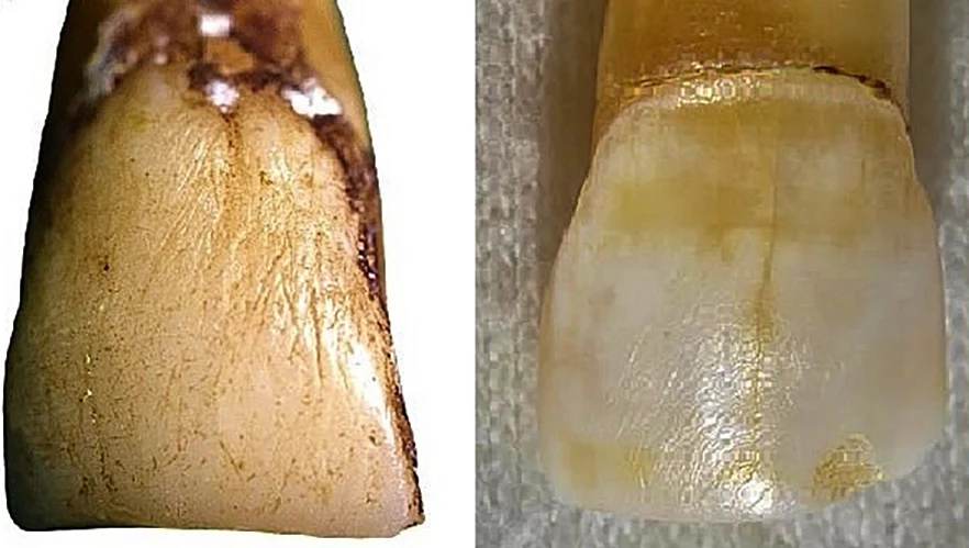 Po lewej ząb makaka japońskiego, a po prawej neandertalczyka