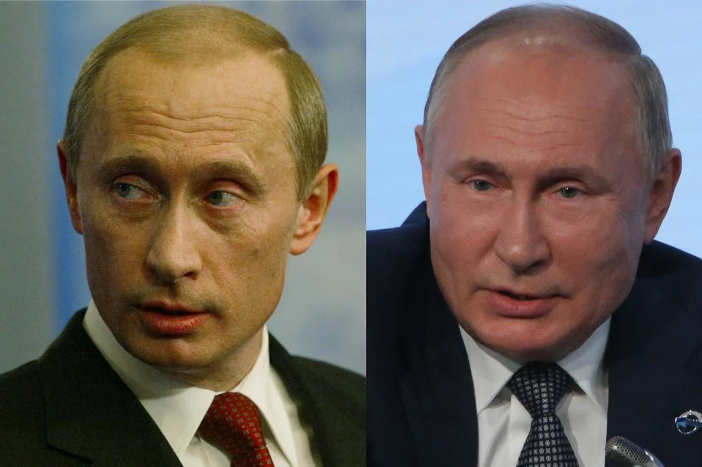 Lekarze są zgodni, że Władimir Putin upodobał sobie zastrzyki z toksyny botulinowej