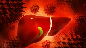 Zarażenie wirusem HCV często nie daje żadnych objawów, ale nieleczone prowadzi do poważnych konsekwencji zdrowotnych