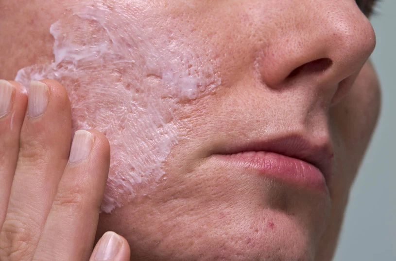 Czy maseczka na twarz ze skrobią ziemniaczaną naprawdę działa jak botoks? Przekonaj się