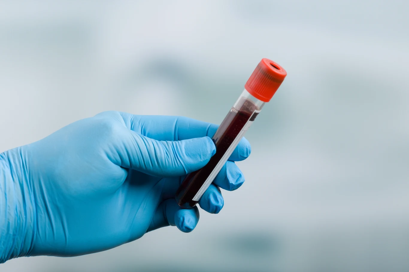 Różnice między grupami krwi są niewidoczne gołym okiem, ale mogą wpływać na metabolizm Pomiar stężenia lipidów we krwi może przewidzieć ryzyko rozwoju cukrzycy typu 2 i chorób układu krążenia w bardzo dalekiej przyszłości - uważają naukowcy
