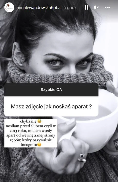 Nikt nie spodziewał się, że Anna Lewandowska mogła mieć kiedyś problemy z zębami
