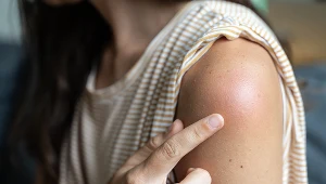 Ból w miejscu wstrzyknięcia był jednym z częściej zgłaszanych NOP-ów