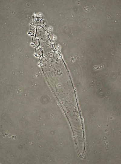 Pasożyt Demodex bialoviensis 