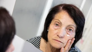 Worki pod oczami mogą wskazywać np. na problemy z tarczycą