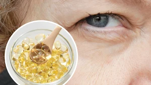 Witamina E jest szczególnie cenna ze względu na właściwości przeciwutleniające. Objawy niedoboru najpierw zobaczysz więc na twarzy