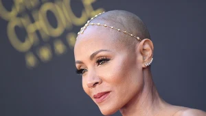 Do łysienia plackowatego przyznała się  Jada Pinkett Smith, żona znanego aktora Willa Smitha