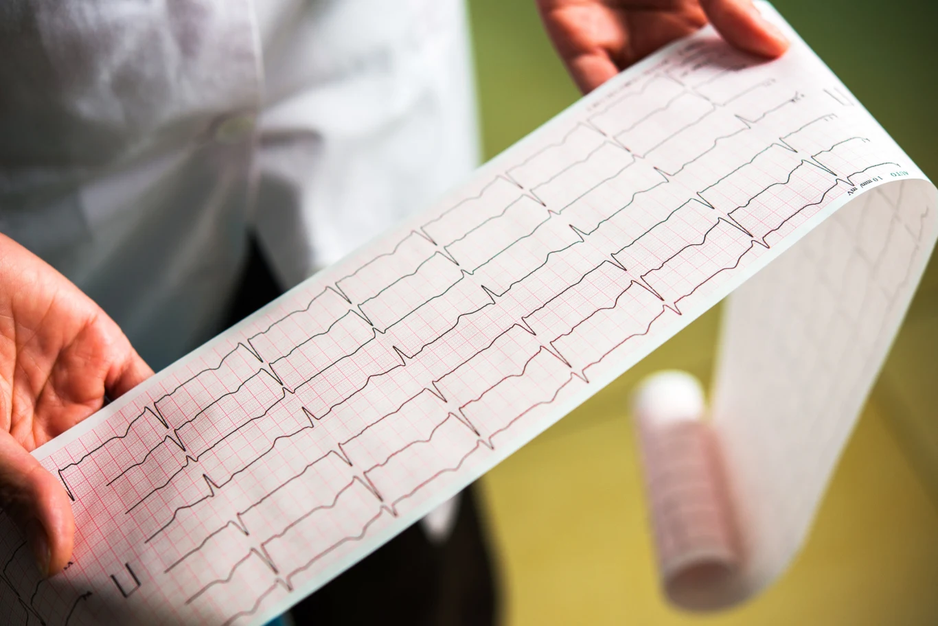 Brak zmian w zapisie EKG nie zawsze świadczy o tym, że nie doszło do zawału mięśnia sercowego