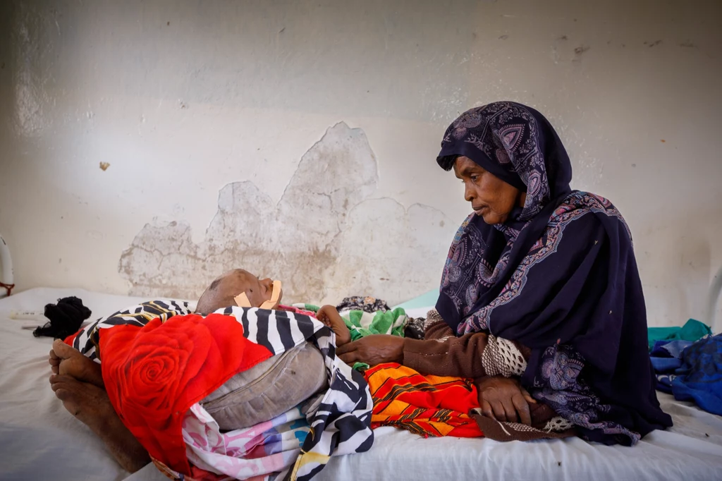 Dziecko ze swoją matką ciepiące z niedożywienia leżące w somalijskim szpitalu.