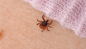 Objawy tularemii są nagłe. Mogą przypominać te obserwowane u osób z tyfusem