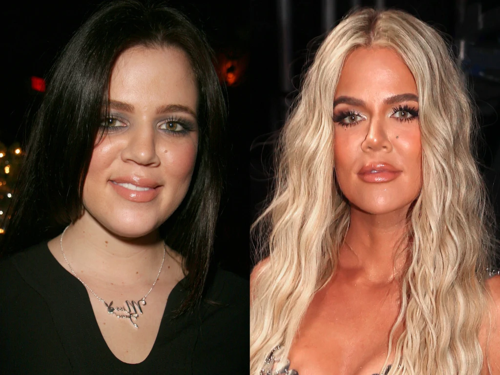Khloe Kardashian przed i po operacji Foto: Christopher Polk Khloe Kardashian przed i po operacji Foto: Christopher Polk