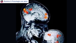 Zdjęcie rezonansu magnetycznego, na którym widać matkę całującą w czoło swojego dwumiesięcznego syna
