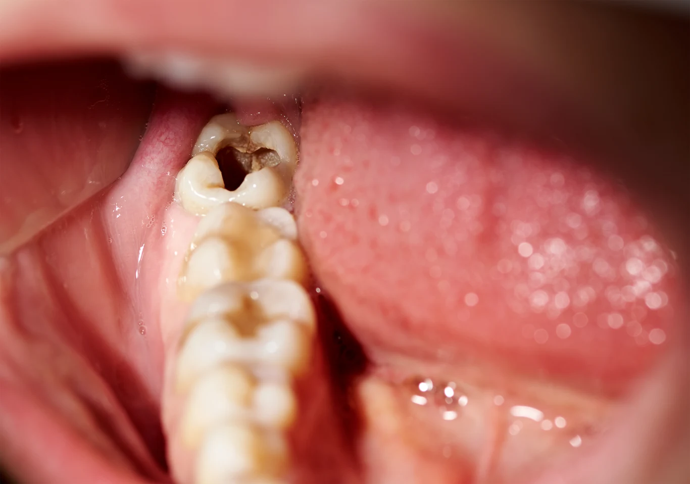 Regularnie odwiedzaj dentystę! Zaoszczędzisz tak pieniądze i czas, a przede wszystkim zadbasz o zdrowie Regularnie odwiedzaj dentystę! Zaoszczędzisz tak pieniądze i czas, a przede wszystkim zadbasz o zdrowie