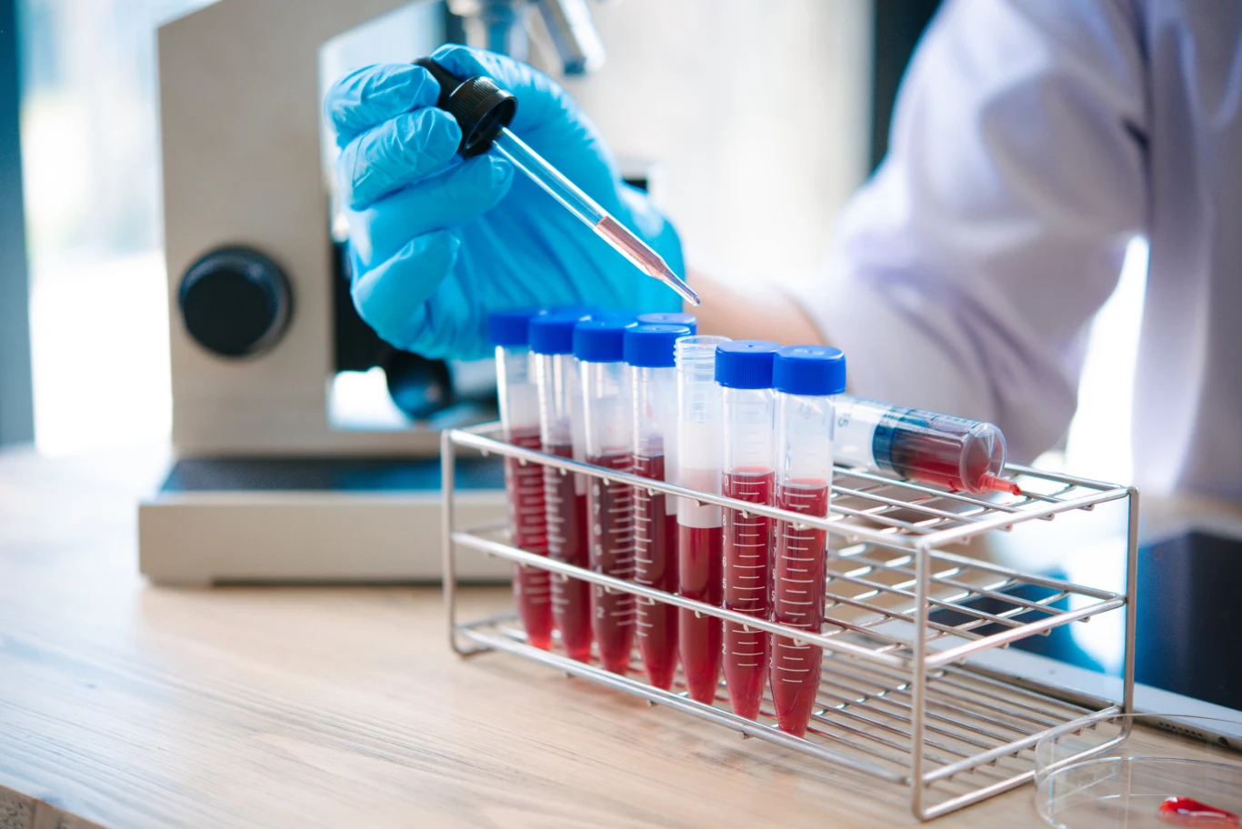 Większość badań z krwi wykonamy bezpłatnie ze skierowaniem od lekarza, w ramach ubezpieczenia zdrowotnego