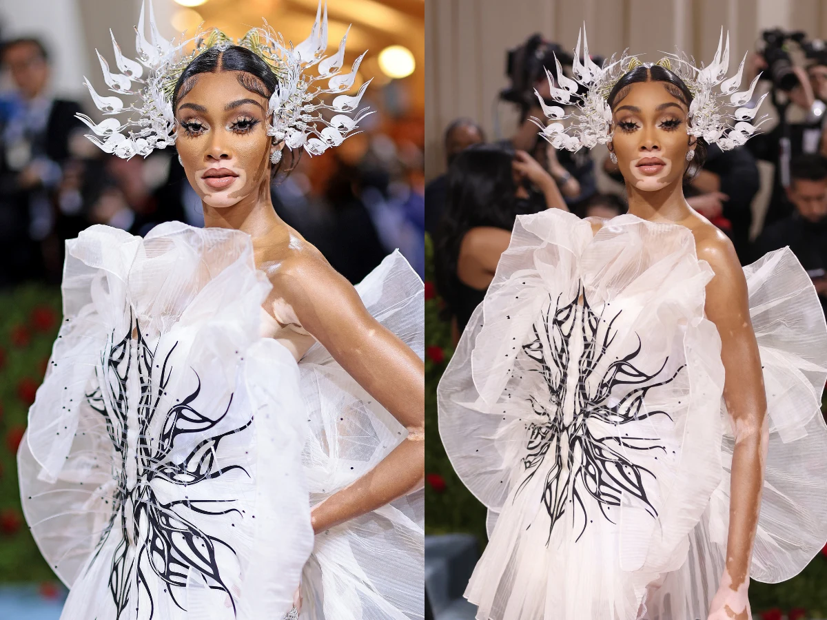 Winnie Harlow Winnie Harlow