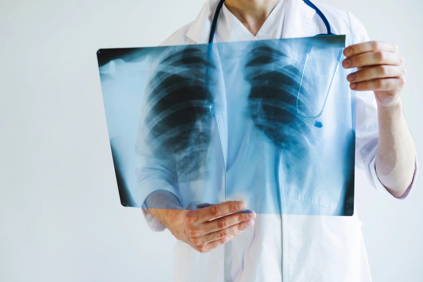 Jeśli masz osteoporozę lub inną chorobę osłabiającą kości, do złamania żeber może dojść nawet przy potknięciu się, zasłabnięciu czy upadku 