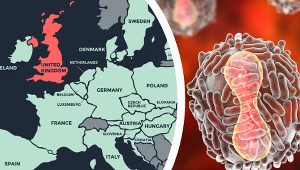 Przypadki małpiej ospy notowane są głównie w krajach Afryki. W ostatnich dniach obecność rzadkiej choroby stwierdzono w Wielkiej Brytanii