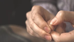 Żółte paznokcie mogą być znakiem problemów ze zdrowiem, np. zespołu żółtych paznokci