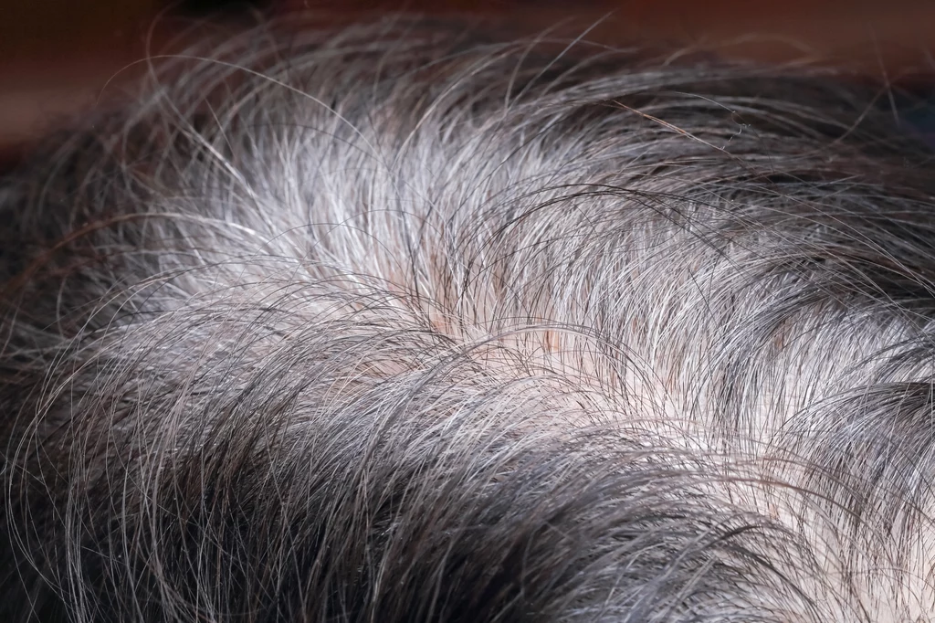 Pierwsze siwe włosy? Wszystko zależy od kwestii genetycznych