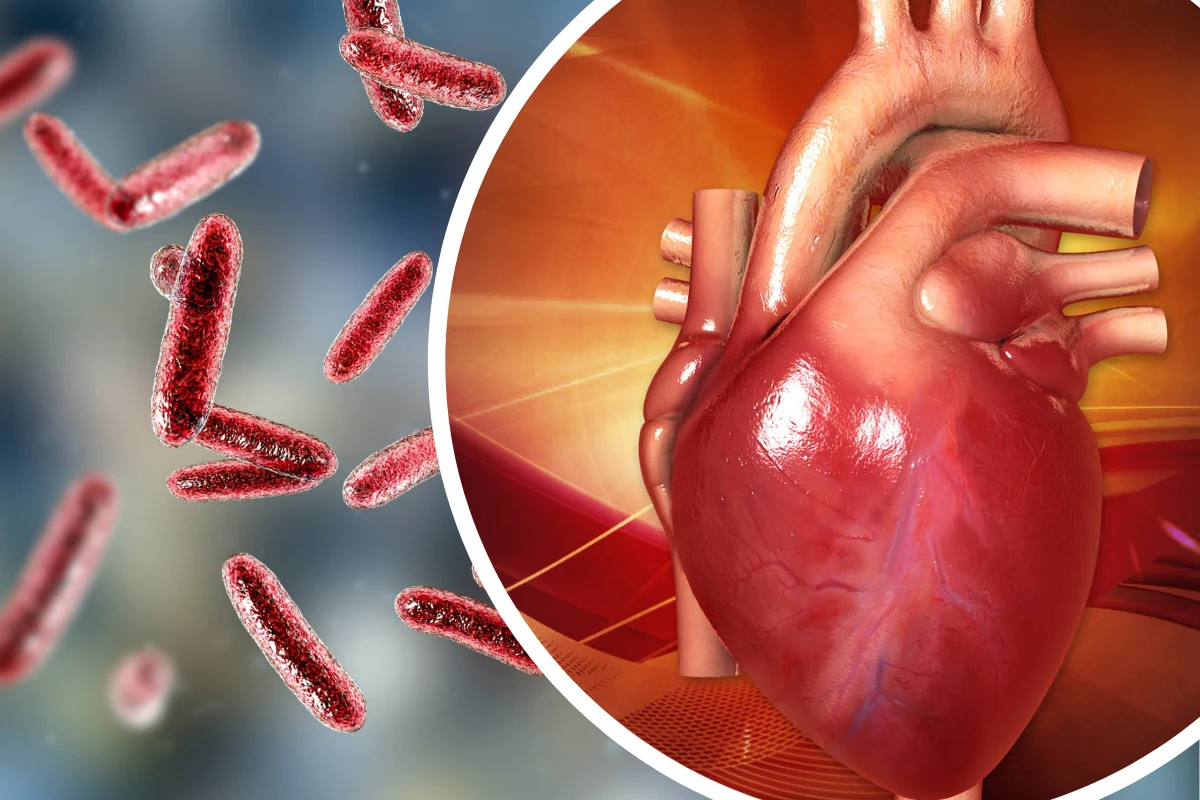 Zapalenie wsierdzia to proces zapalny, którym zostaje objęta błona wyściełająca jamy serca, jego zastawki i naczynia z nim połączone Zapalenie wsierdzia to proces zapalny, którym zostaje objęta błona wyściełająca jamy serca, jego zastawki i naczynia z nim połączone