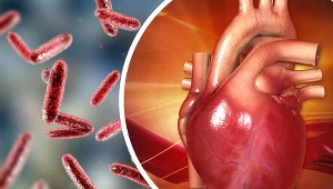 Wybroczyny i guzki na palcach. Drobnoustroje zaatakowały ważny mięsień