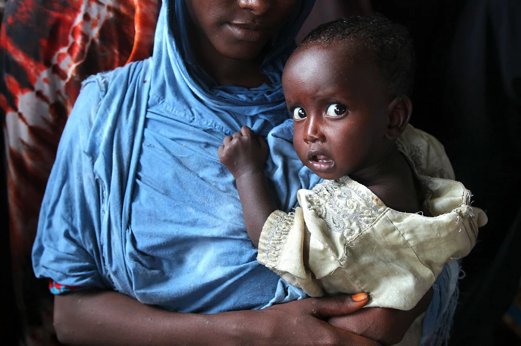 Susza w Rogu Afryki może spowodować szybki wzrost liczby głodujących dzieci z 1,7 mln do 2 mln. Najwięcej dzieci dotkniętych zaburzeniem przyrostu masy ciała mieszka w Azji Południowej
