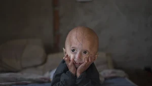 W rok starzeją się o osiem lat. Dzieci umierają z powodu zawału lub udaru