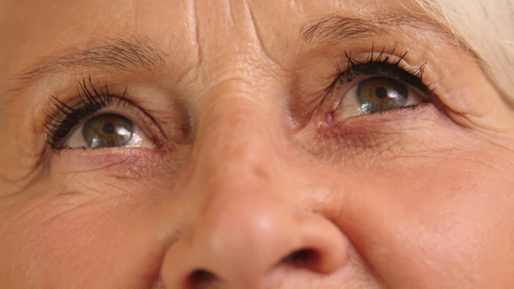 Męty występują najczęściej u osób starszych, między 50. a 75. rokiem życia