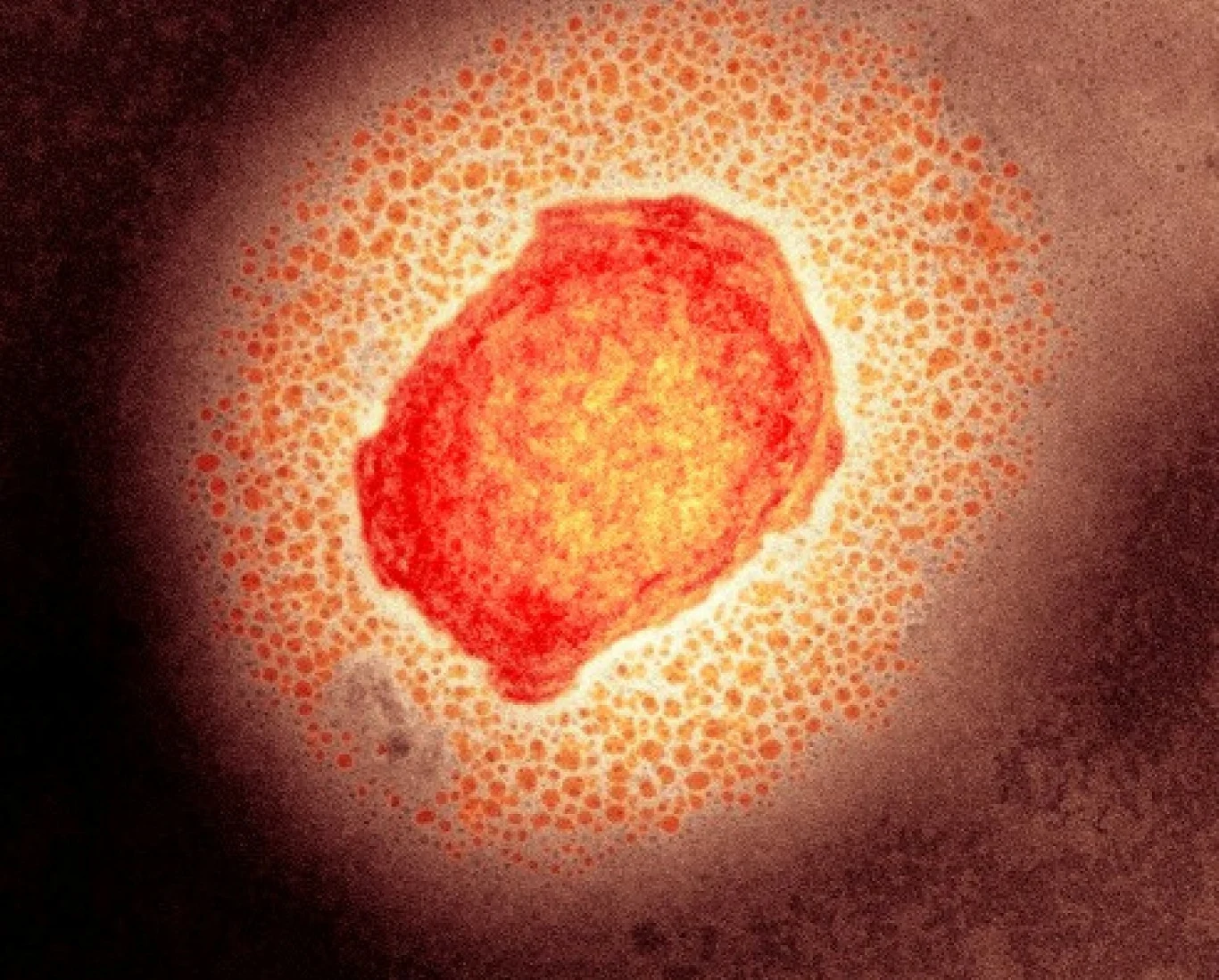 Wirus małpiej ospy Wirus małpiej ospy