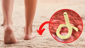 Unikaj chodzenia boso po plaży. Odradza się też leżenia i siedzenia na gołym piasku