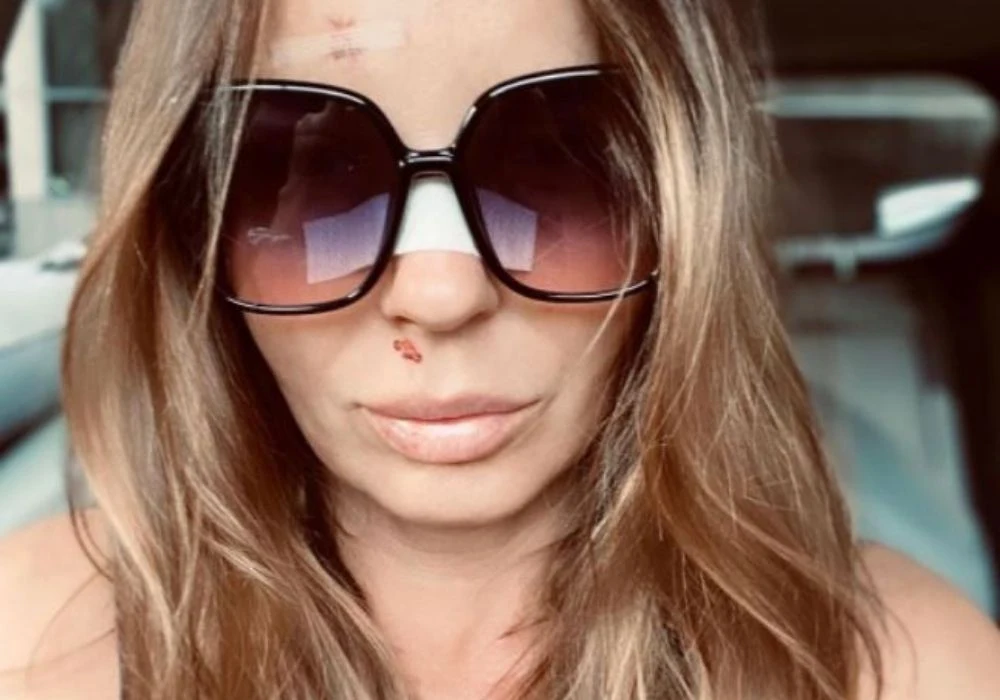 Agnieszka Włodarczyk trafiła do szpitala Agnieszka Włodarczyk trafiła do szpitala