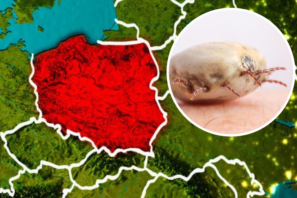 W Polsce odnotowano wzrost przypadków boreliozy. Przedstawiamy podstawowe informacje na temat tej podstępnej choroby W Polsce odnotowano wzrost przypadków boreliozy. Przedstawiamy podstawowe informacje na temat tej podstępnej choroby