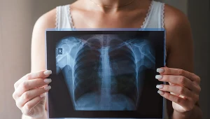 Zgromadzenie wody w płucach może świadczyć o groźnej chorobie