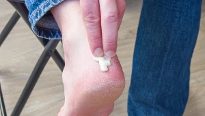 Ta maść z apteki w mig wygładza zniszczone pięty. W sam raz do sandałów