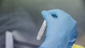 Potwierdzono przypadki małpiej ospy w woj. warmińsko-mazurskim